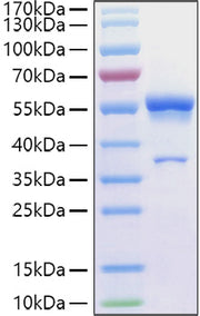Recombinant Human Ephrin-A1/EFNA1 Protein