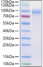 Recombinant Human Fibronectin/CIG/FN1 Protein