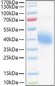 Recombinant Human TFPI Protein