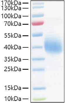 Recombinant Human TFPI Protein