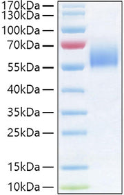 Recombinant Human IL-36R/IL-1Rrp2/IL1RL2 Protein