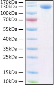 Recombinant Human PIgR Protein