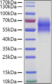 Recombinant Human WAIF1/5T4/TPBG Protein