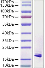 Recombinant Human TNFSF12/TWEAK Protein