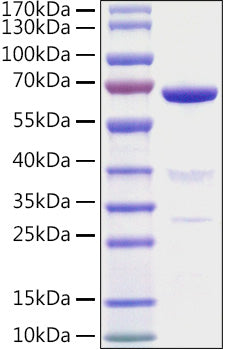 Recombinant Mouse 5'-Nucleotidase/NT5E/CD73 Protein