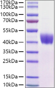 Recombinant Mouse Mesothelin/MSLN Protein