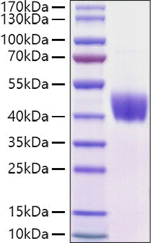Recombinant Mouse Mesothelin/MSLN Protein