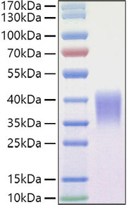 Recombinant Mouse Ephrin-B2/EFNB2 Protein