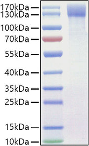 Recombinant Mouse OSMR/IL-31RB Protein