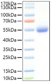 Recombinant Mouse IL-5RA/CD125 Protein