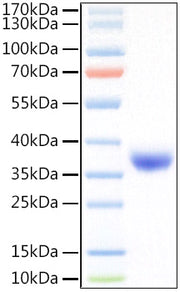 Recombinant SARS-COV-2 Spike RBD(L452R,T478K)  Protein