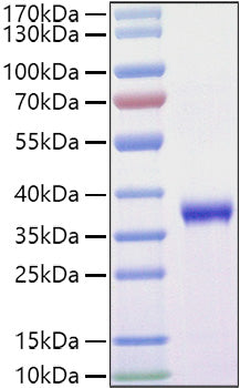 Recombinant SARS-COV-2 Spike RBD(L452R,T478K)  Protein