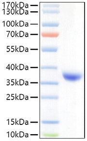 Recombinant SARS-COV-2 Spike RBD(Lambda/C.37)  Protein