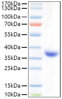 Recombinant SARS-COV-2 Spike RBD(Lambda/C.37)  Protein