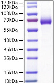Recombinant Mouse IL-2RA/CD25 Protein