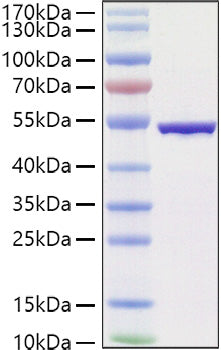 Recombinant SARS-COV-2 Nucleocapsid(B.1.1.529/Omicron) Protein