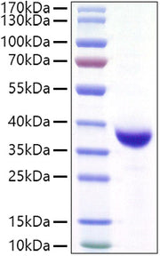 Recombinant SARS-CoV-2 Spike RBD(Lambda/C.37)  Protein