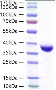 Recombinant SARS-CoV-2 Spike RBD(Lambda/C.37)  Protein