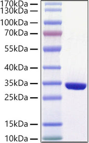 Recombinant Human Glutathione S-transferase omega-1/GSTO-1/SPG-R Protein