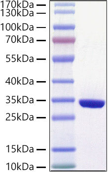 Recombinant Human Glutathione S-transferase omega-1/GSTO-1/SPG-R Protein