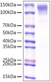 Recombinant Mouse Low-density lipoprotein receptor/LDLR Protein