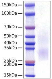 Recombinant Rat PD-1/PDCD1/CD279 Protein