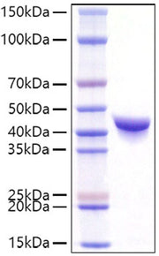 Recombinant Mouse YKL-40/CHI3L1 Protein