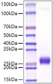 Recombinant Mouse Ephrin-A2/EFNA2 Protein
