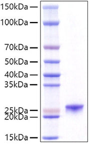 Recombinant Mouse Prolactin/PRL Protein
