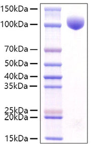 Recombinant Mouse c-kit/CD117 Protein