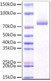 Recombinant Human CLEC7A/Dectin-1/CD369 Protein