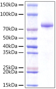 Recombinant Human Integrator complex subunit 14/VWA9/INTS14 Protein