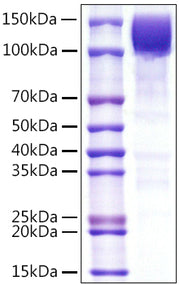 Recombinant Human PTPRC/CD45RA/CD45 Protein