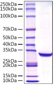 Recombinant Human PSA/KLK3 Protein
