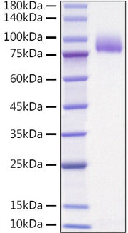 Recombinant Human IL-1 Rrp2/IL-1 R6 Protein