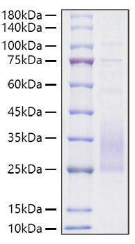 Recombinant Mouse TREM2 Protein