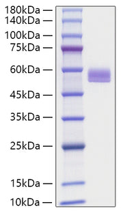 Recombinant Mouse Serpin F1/PEDF Protein