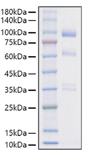Recombinant Mouse Hepatocyte growth factor/HGF Protein