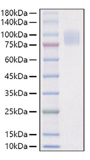 Recombinant Mouse IL-17RA/CD217 Protein