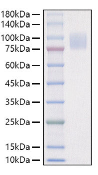 Recombinant Mouse IL-17RA/CD217 Protein