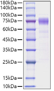 Recombinant Human IL-10RA/CD210 Protein