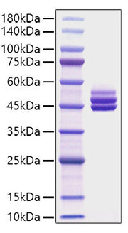 Recombinant Mouse IL-12B/IL-12 p40 Protein