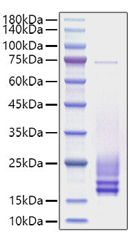 Recombinant Rat Cystatin-C/CST3 Protein