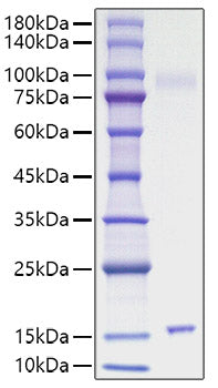 Recombinant Mouse IL-15 Protein