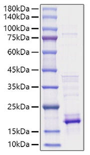 Recombinant Human IL-21 Protein