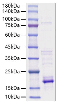 Recombinant Human IL-21 Protein