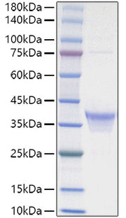 Recombinant Human IL-34 Protein