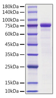 Recombinant Mouse E-Cadherin/CDH1/CD324 Protein