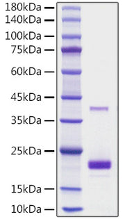 Recombinant Mouse TNFSF5/CD40 ligand/CD154 Protein