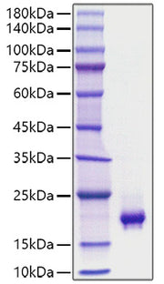 Recombinant Mouse PDGF-BB Protein
